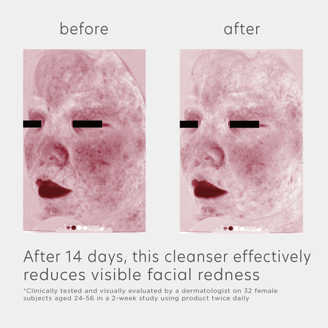 after 14 days, this cleanser effectively reduces visible facial redness