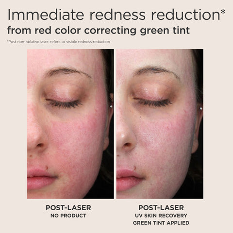 Immediate redness reduction - from red color correcting green tint