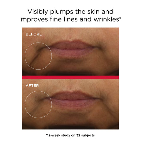 Before and after comparison of skin plumping and wrinkle improvement with text indicating a study on 32 subjects.