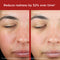Slide 4 - EltaMD UV Skin Recovery Broad Spectrum SPF 50 Face Sunscreen