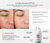 Advertisement for UV Skin Recovery SPF 50 sunscreen with before and after effects on skin.