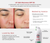 Advertisement for UV Skin Recovery SPF 50 sunscreen with before and after effects on skin.